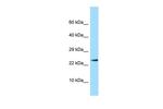 IL17B Polyclonal Antibody
