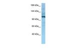 MORC4 Polyclonal Antibody