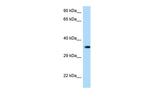 MARCH2 Polyclonal Antibody