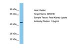 MARCH11 Antibody in Western Blot (WB)