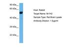 LXR beta Polyclonal Antibody