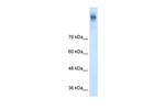 NKCC1 Polyclonal Antibody