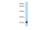 CTR1 Polyclonal Antibody