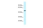 SLC1A4 Polyclonal Antibody