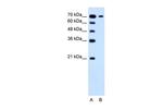 SLC5A4 Polyclonal Antibody