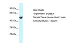 SLC25A25 Antibody in Western Blot (WB)