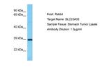 SLC25A35 Antibody in Western Blot (WB)