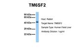TM6SF2 Polyclonal Antibody