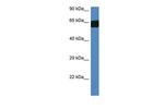 FMO3 Polyclonal Antibody