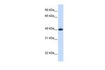 VSIG8 Polyclonal Antibody