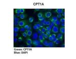 CPT1A Polyclonal Antibody