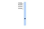 TMEM75 Polyclonal Antibody