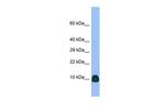 ATP6V0B Polyclonal Antibody
