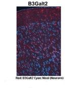 B3GALT2 Polyclonal Antibody