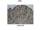 CPS1 Antibody in Immunohistochemistry (IHC)