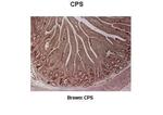 CPS1 Antibody in Immunohistochemistry (IHC)