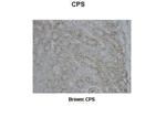 CPS1 Antibody in Immunohistochemistry (IHC)