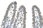 CPS1 Antibody in Immunohistochemistry (IHC)