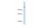 CPS1 Antibody in Western Blot (WB)