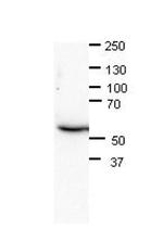 CAF1 p60 Antibody in Western Blot (WB)