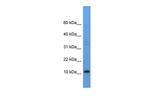 CYYR1 Antibody in Western Blot (WB)