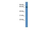 ADAM23 Polyclonal Antibody