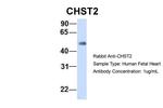 CHST2 Antibody in Western Blot (WB)
