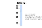 CHST2 Polyclonal Antibody