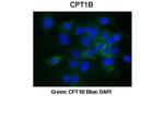CPT1B Polyclonal Antibody