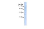 IMPG2 Polyclonal Antibody
