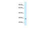 TMEM106B Polyclonal Antibody
