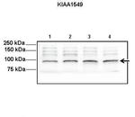 KIAA1549 Polyclonal Antibody