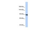 KIAA1549 Antibody in Western Blot (WB)