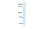 prd Polyclonal Antibody