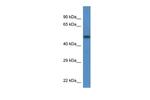 TCN2 Polyclonal Antibody