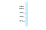 GCAT Polyclonal Antibody