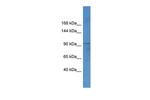 FTSJ3 Polyclonal Antibody