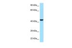 GMPPB Polyclonal Antibody