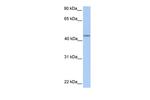 PNPLA5 Polyclonal Antibody