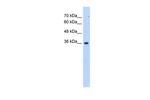 ALG1L6P Antibody in Western Blot (WB)