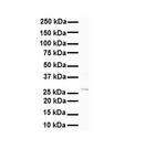 METTL11B Polyclonal Antibody