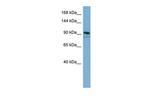 FAM62B Polyclonal Antibody