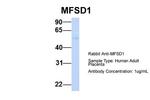 MFSD1 Antibody in Western Blot (WB)
