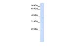 GDAP1L1 Polyclonal Antibody