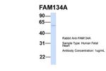 FAM134A Polyclonal Antibody