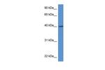 ZDHHC11 Polyclonal Antibody