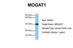 MOGAT1 Polyclonal Antibody