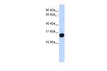 TCEAL4 Polyclonal Antibody