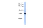 ZNF705D Polyclonal Antibody