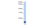 ZNF826P Polyclonal Antibody